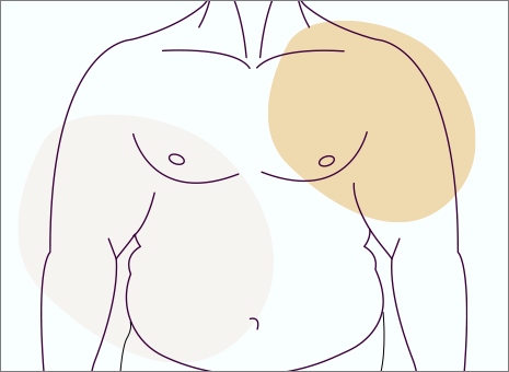 Male Breast Reduction Featured Image