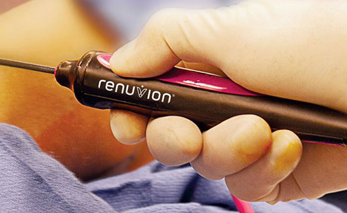 Renuvion (J-Plasma) Devices Services Image - Australia Cosmetic Clinic by Dr Mark Kohout