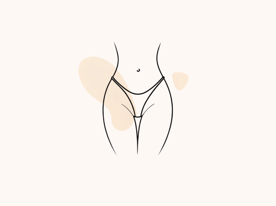 Everything You Need to Know About FUPA Liposuction Featured Image