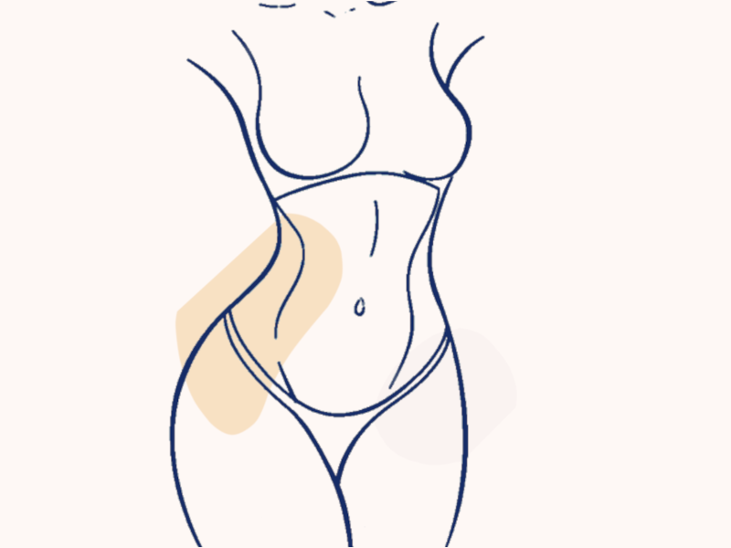 Laser Liposuction Your Guide to the Procedure, Benefits, and More Featured Image with bkground