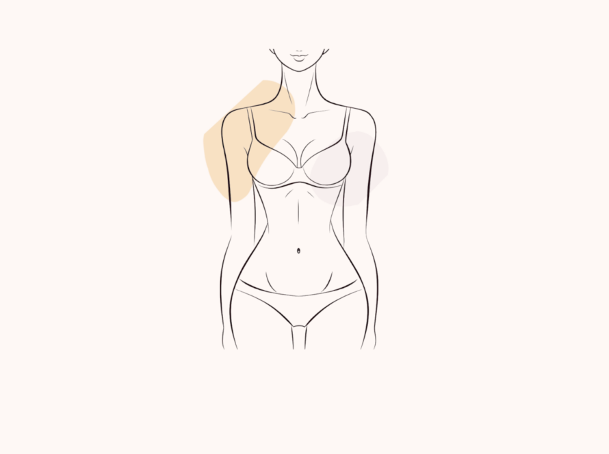 Recovery Bra Bulge Liposuction Your Comprehensive Guide Featured Image