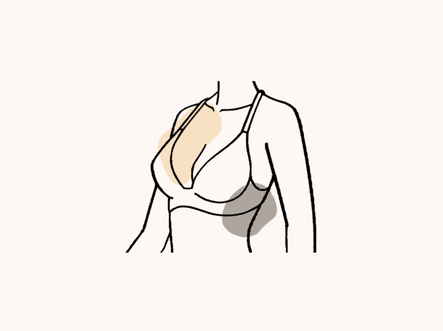 Recovery After Breast Reduction (Reduction Mammoplasty) Featured Image