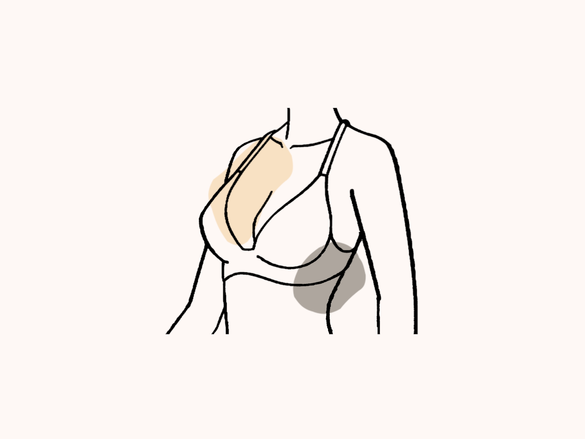 Recovery After Breast Reduction (Reduction Mammoplasty) Featured Image