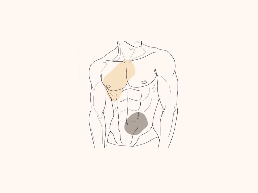 Managing Gyno Scars After Male Chest Surgery