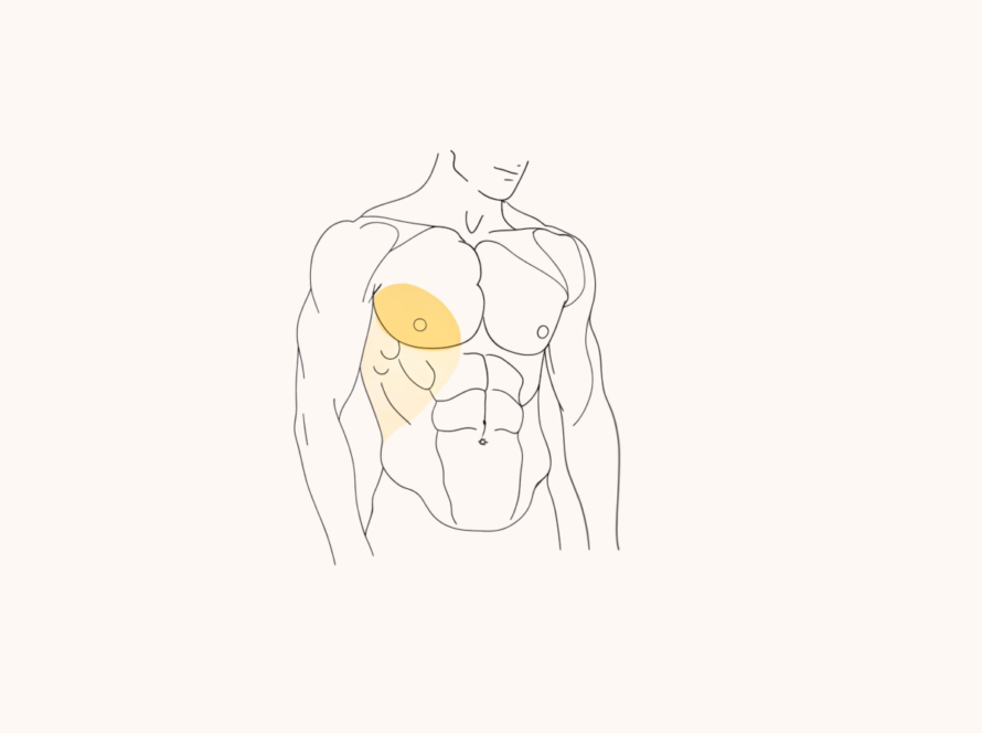 Recovery after Gynecomastia Surgery Male Breast Reduction Featured Image