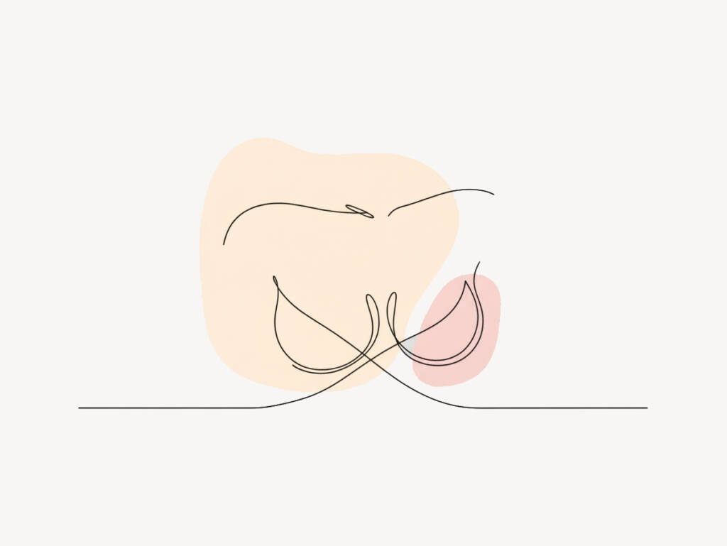 Big Breast Implants: How Big is too Big by Dr Mark Kohout