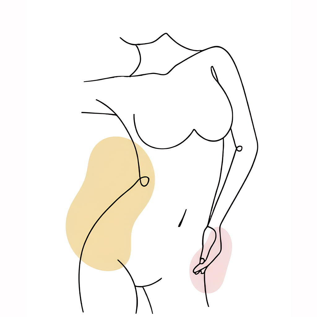 flank liposuction thumbnail
