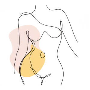 Can Patients With Split Muscles Have Liposuction by ACC