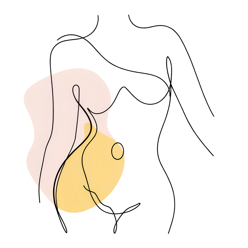 Can Patients With Split Muscles Have Liposuction?