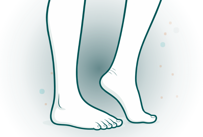 Ankle Liposuction