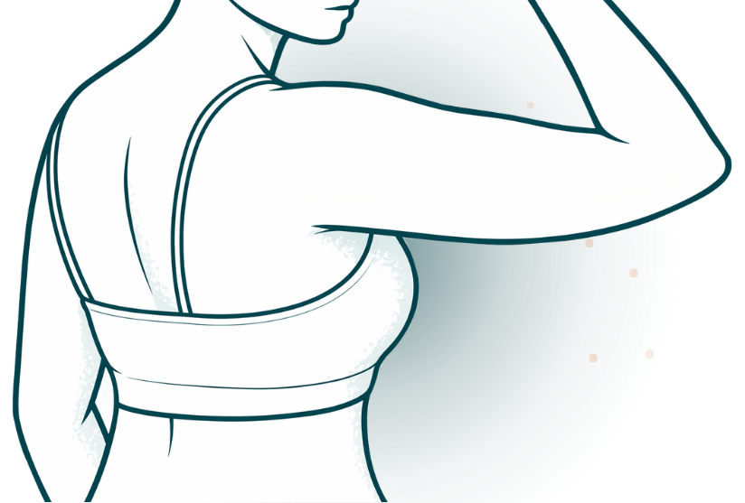 Arm Liposuction