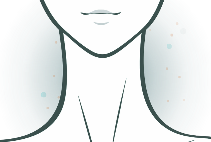 Chin liposuction procedure for submental fat reduction and jawline contouring Sydney