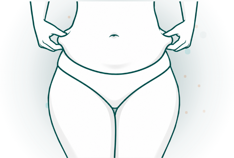Flank Liposuction