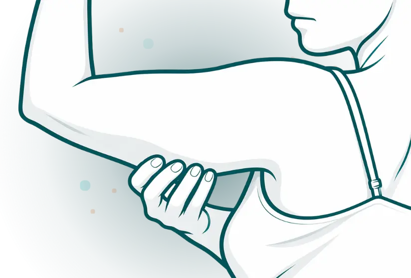 Arm Liposuction with Tightening